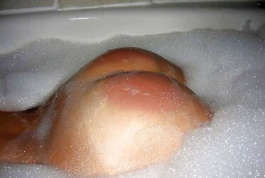 Slapped in bath