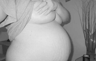 Vergeture - grossesse