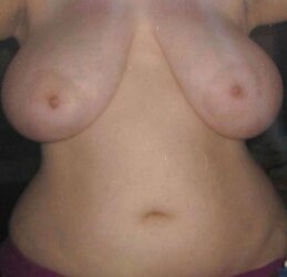 Big-Boobed Titty Reductions - Set
