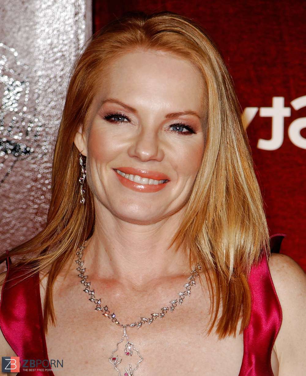 Marg helgenberger plastic surgery